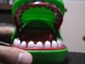Crocodile Dentist: Thumbtack Edition For Sadomasochists